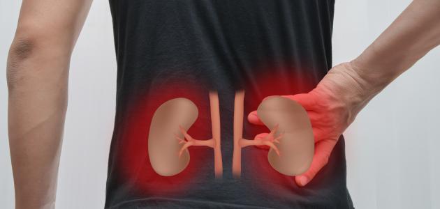 أعراض التهاب الكلى صورة مقال أعراض التهاب الكلى