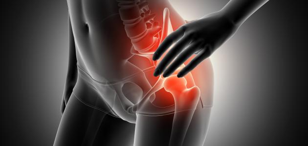 التهاب العصب الوركي صورة مقال التهاب العصب الوركي