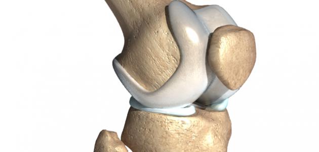 التهاب العظام صورة مقال التهاب العظام