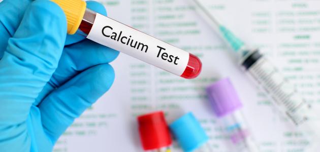 تحليل نسبة الكالسيوم في الدم صورة مقال تحليل نسبة الكالسيوم في الدم