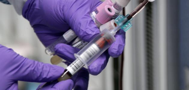 تحليل الزهري صورة مقال تحليل الزهري