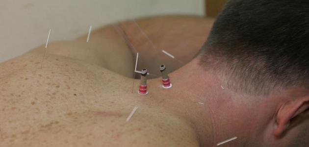 أفضل علاج للوتاب صورة مقال أفضل علاج للوتاب