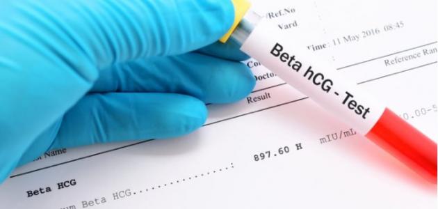 أسرع طريقة لمعرفة الحمل صورة مقال أسرع طريقة لمعرفة الحمل
