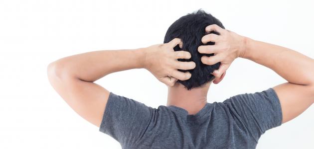 أضرار حك فروة الرأس صورة مقال أضرار حك فروة الرأس