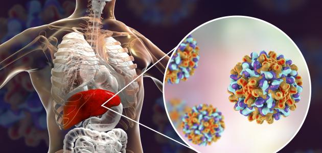 تحليل فيروسات الكبد صورة مقال تحليل فيروسات الكبد