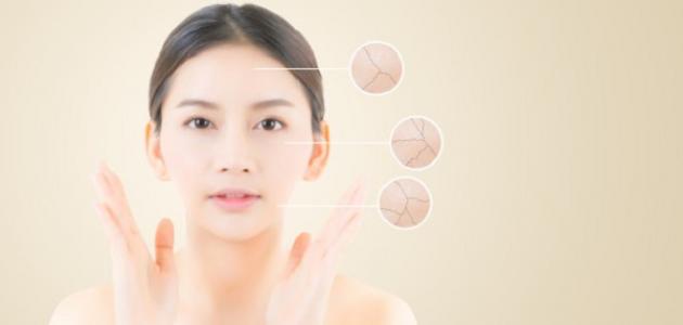 البشره الباهتة صورة مقال البشره الباهتة