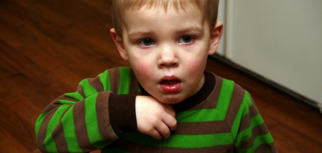 التهاب القصبات الحاد صورة مقال التهاب القصبات الحاد