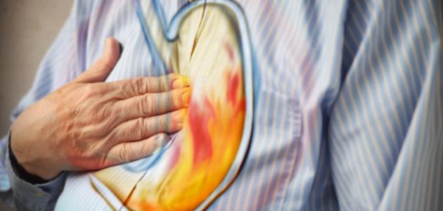 كيفية التخلص من الحموضة صورة مقال كيفية التخلص من الحموضة
