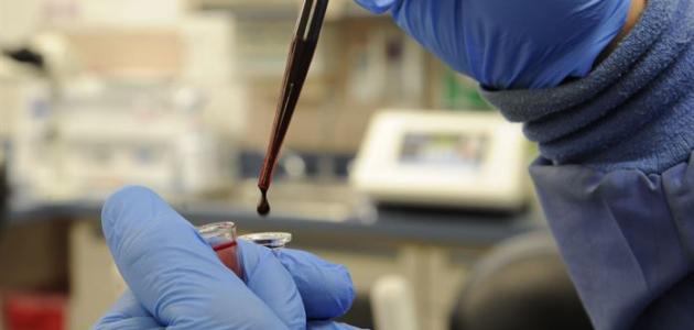 تحليل fsh للرجال صورة مقال تحليل fsh للرجال