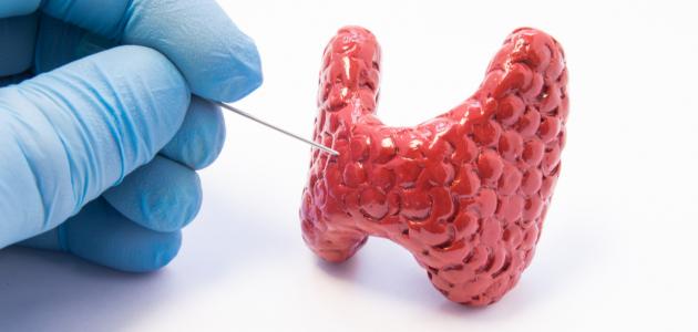 أضرار خزعة الغدة الدرقية صورة مقال أضرار خزعة الغدة الدرقية