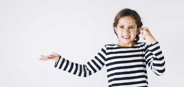 آثار الجرب صورة مقال آثار الجرب