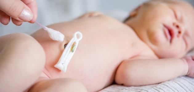 التهاب سرة الطفل حديث الولادة صورة مقال التهاب سرة الطفل حديث الولادة