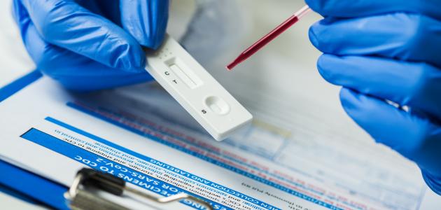 تحاليل المناعة صورة مقال تحاليل المناعة