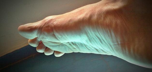 أسباب الوخز في الأطراف صورة مقال أسباب الوخز في الأطراف