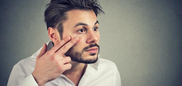 أسباب ضباب العين صورة مقال أسباب ضباب العين