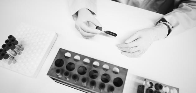 كيف ينتقل مرض السيدا صورة مقال كيف ينتقل مرض السيدا