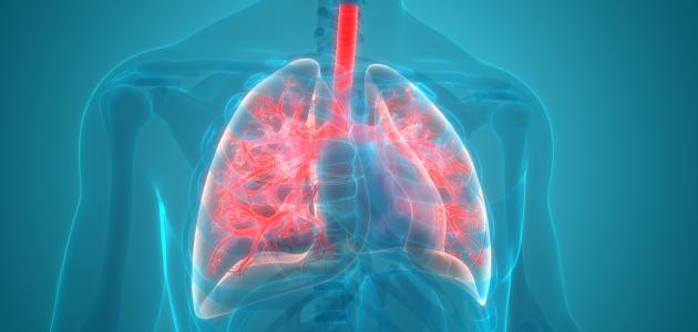 التهاب ذات الرئة الحاد صورة مقال التهاب ذات الرئة الحاد