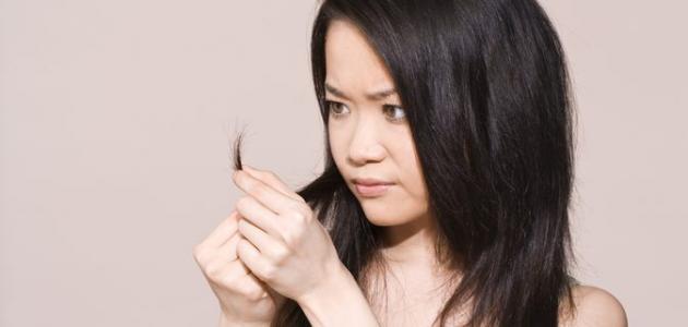 كيفية العناية بالشعر المتساقط للنساء صورة مقال كيفية العناية بالشعر المتساقط للنساء