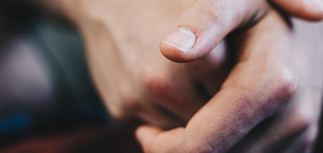 أسباب تلف الأعصاب صورة مقال أسباب تلف الأعصاب