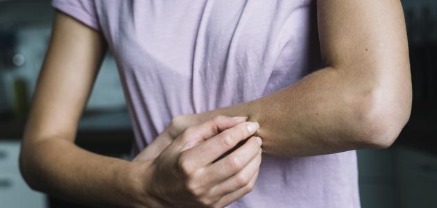 كيفية التخلص من حكة الجسم صورة مقال كيفية التخلص من حكة الجسم