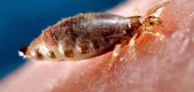 كيفية التخلص من قمل الجسم صورة مقال كيفية التخلص من قمل الجسم