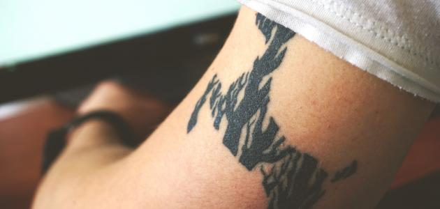 طريقة إزالة الوشم بدون ليزر صورة مقال طريقة إزالة الوشم بدون ليزر