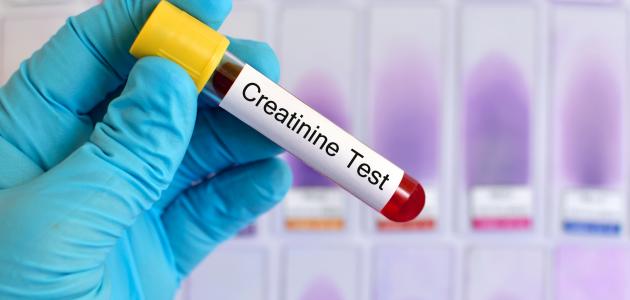 أضرار ارتفاع وظائف الكلى صورة مقال أضرار ارتفاع وظائف الكلى