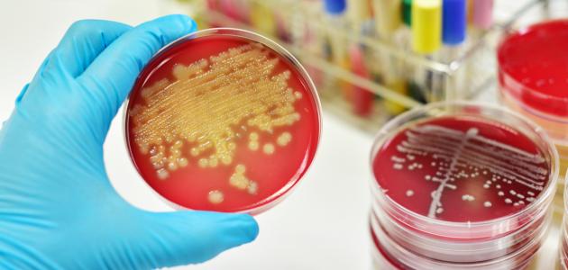 ما هو تحليل مزرعة الدم صورة مقال ما هو تحليل مزرعة الدم