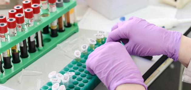 فحص الحمل بالدم صورة مقال فحص الحمل بالدم