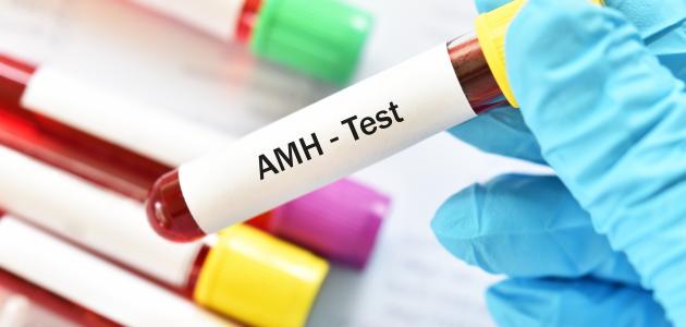 ما هو تحليل مخزون البويضات صورة مقال ما هو تحليل مخزون البويضات