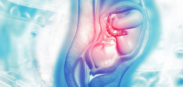 أنواع نزول المشيمة صورة مقال أنواع نزول المشيمة