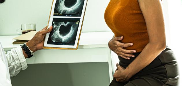 ألم الكيس على المبيض صورة مقال ألم الكيس على المبيض