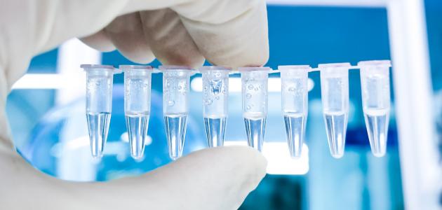 ما هو تحليل الغدة النكافية صورة مقال ما هو تحليل الغدة النكافية