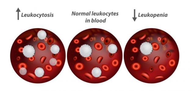 ارتفاع الكريات البيضاء صورة مقال ارتفاع الكريات البيضاء