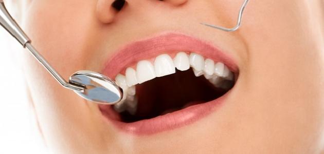 ما أسباب التهاب اللثة صورة مقال ما أسباب التهاب اللثة