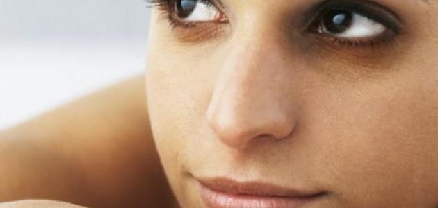 الهالات السوداء تحت العين صورة مقال الهالات السوداء تحت العين