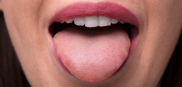 ما أسباب خدر اللسان صورة مقال ما أسباب خدر اللسان