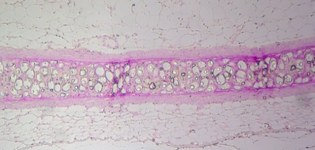 مقارنة بين الأنسجة الطلائية والأنسجة الضامة صورة مقال مقارنة بين الأنسجة الطلائية والأنسجة الضامة
