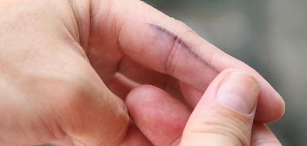 كيف أزيل الحبر عن اليد صورة مقال كيف أزيل الحبر عن اليد