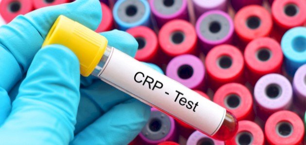 ما هو تحليل CRP صورة مقال ما هو تحليل CRP