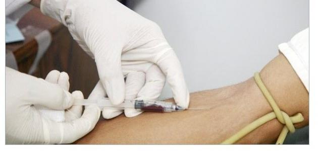 ما هو تحليل Hb Electrophoresis صورة مقال ما هو تحليل Hb Electrophoresis