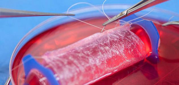 ما هي أعراض تسمم الدم صورة مقال ما هي أعراض تسمم الدم