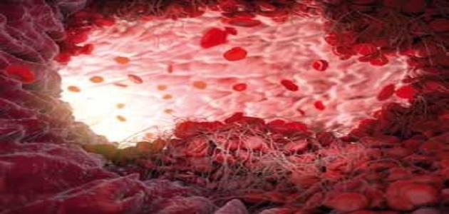 ما هو علاج تجلط الدم صورة مقال ما هو علاج تجلط الدم