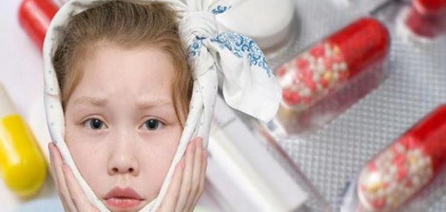 ما هي أعراض الغدة النكافية صورة مقال ما هي أعراض الغدة النكافية