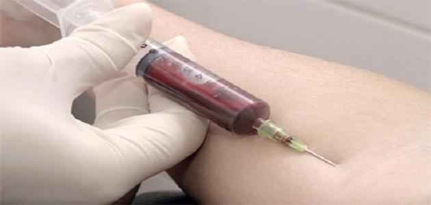 ما هو تحليل MCHC صورة مقال ما هو تحليل MCHC