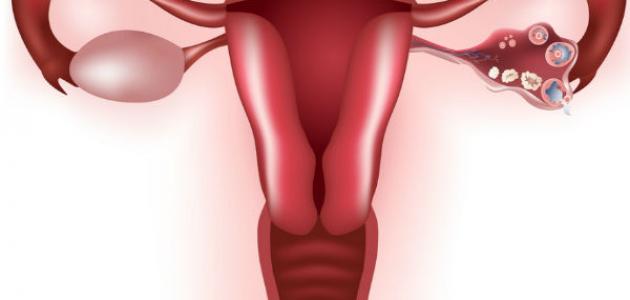 ما هو كيس المبيض صورة مقال ما هو كيس المبيض