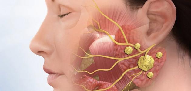 ما هي الأمراض التي تنتقل عن طريق اللعاب صورة مقال ما هي الأمراض التي تنتقل عن طريق اللعاب