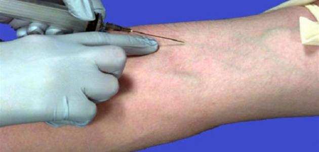 طريقة سحب الدم صورة مقال طريقة سحب الدم