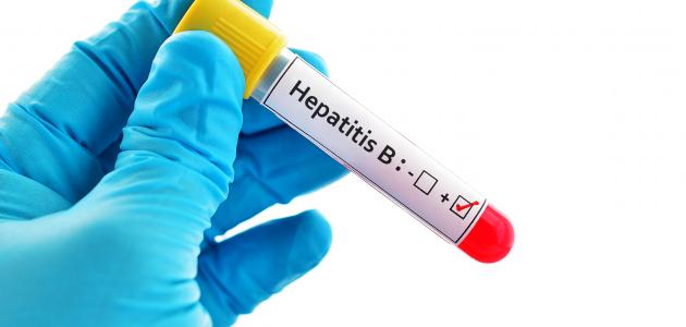 طرق انتقال التهاب الكبد الوبائي ب صورة مقال طرق انتقال التهاب الكبد الوبائي ب