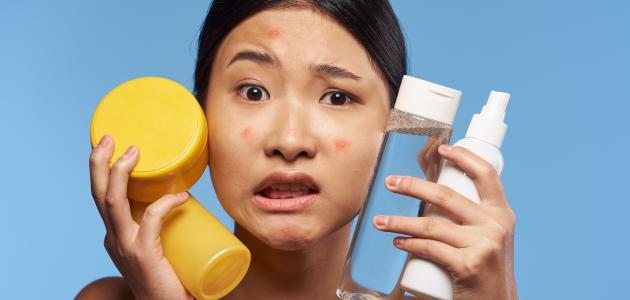 طرق إزالة حبوب الوجه صورة مقال طرق إزالة حبوب الوجه